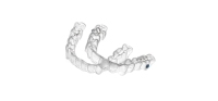 Invisalign Invisible Braces