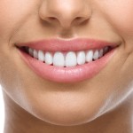 Want a Movie Star Smile? Want a Movie Star Smile?