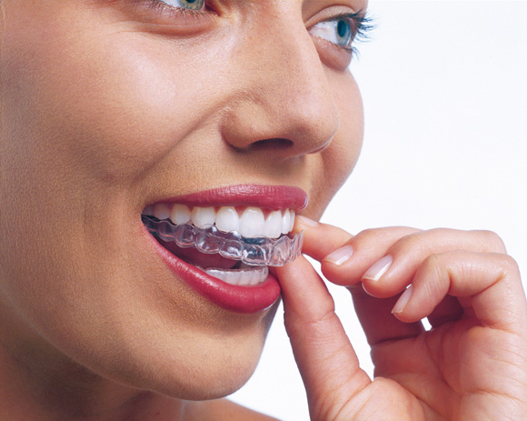 A close up of a woman smiling and pulling out her plastic invisalign