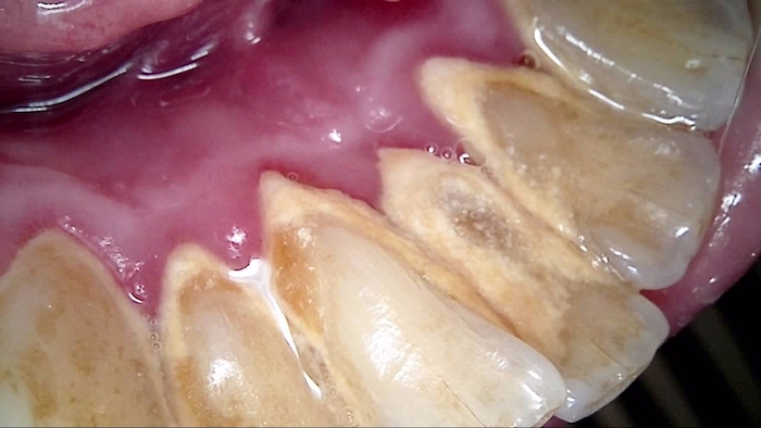 A Close up of yellowing back of teeth
