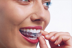 A close up of a woman pulling invisalign out of her teeth