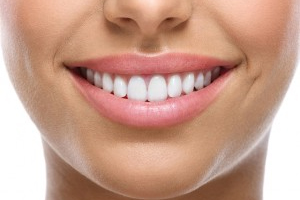 A close up of a young woman's symmetrical and bright white teeth