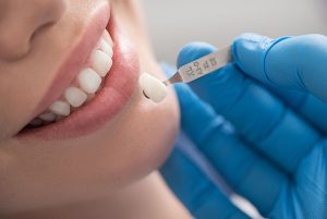 A dentist holding a faux tooth up to a woman's smile for comparison