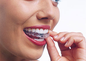 A woman pulling out her invisalign treatment from her teeth