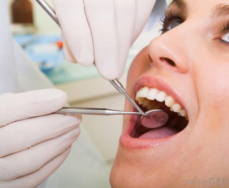 A dentist inspecting a woman's mouth with a tiny mirror