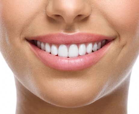A smiling woman showing off symmetrical dental veneers