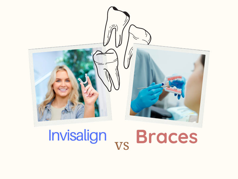 invisalign vs braces