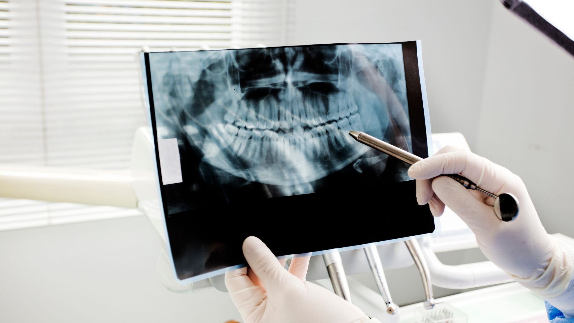 dental xray