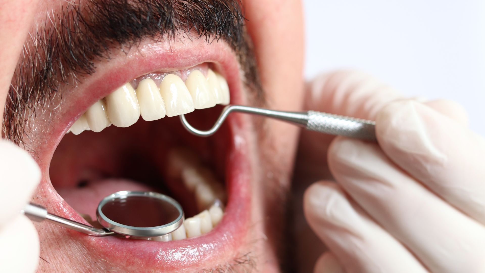 getting a dental checkup